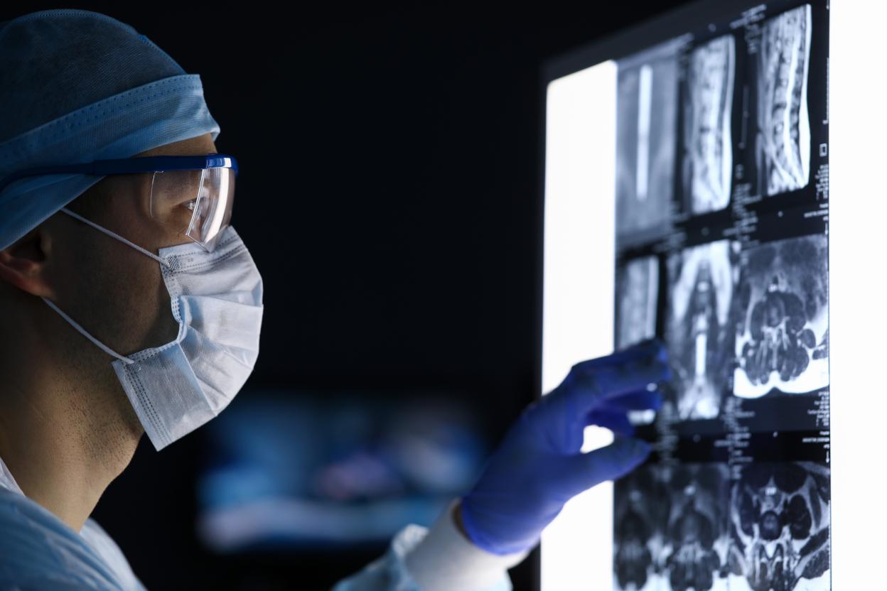 megaflopp iStock Getty Images Plus Ein Arzt betrachtet eine Röntgenaufnahme